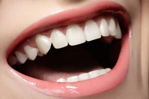 牙齿好像患上“春节病”？四种口腔问题，几大防治举措建议了解